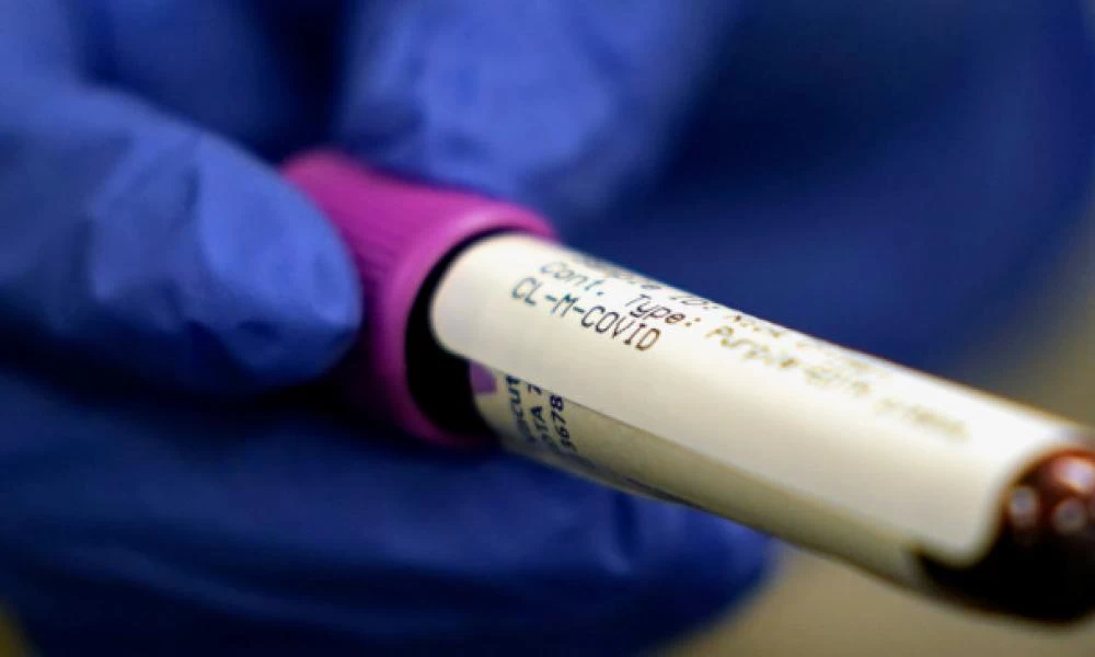 «Διαβατήρια ανοσίας»: Τι είναι και πώς μπορούν να βοηθήσουν την οικονομία